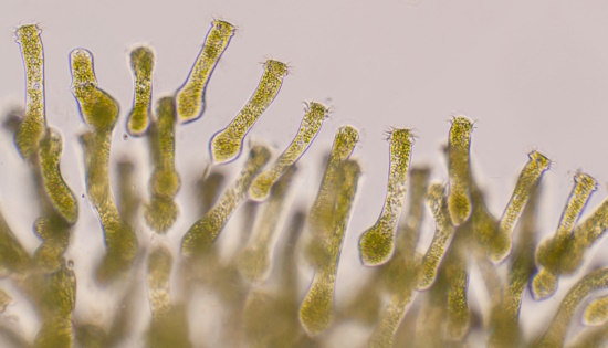 Ophrydium gehört zu den Wimpertierchen - Ciliaten (Bild: © Dr.Hubert Blatterer)