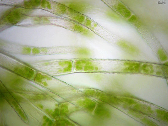 Das Filzige Haarkelchmoos ist ein Indikator in bedrohten Lebensräumen (Aufnahme: © Norbert Stapper / BLAM e.V.) Das Filzige Haarkelchmoos ist ein Indikator in bedrohten Lebensräumen (Aufnahme: © Norbert Stapper / BLAM e.V.)