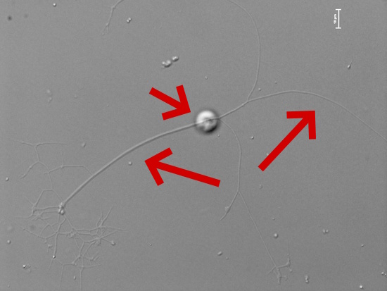 Lichtmikroskopische Aufnahme zeigt: einen kleinen Körper und lange Arme 'zwei Pfeile' (Aufnahme: © Prof. Dr. Kenneth Dumack / Uni Koblenz)