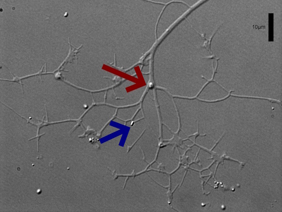 Lichtmikroskopische Aufnahme: Bakterium im Fangnetz (rot) - freies Bakterium (blau) (Aufnahme: © Prof. Dr. Kenneth Dumack / Uni Koblenz)